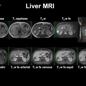 7. Chmelik_MRS_and_MRI_liver2 (1)